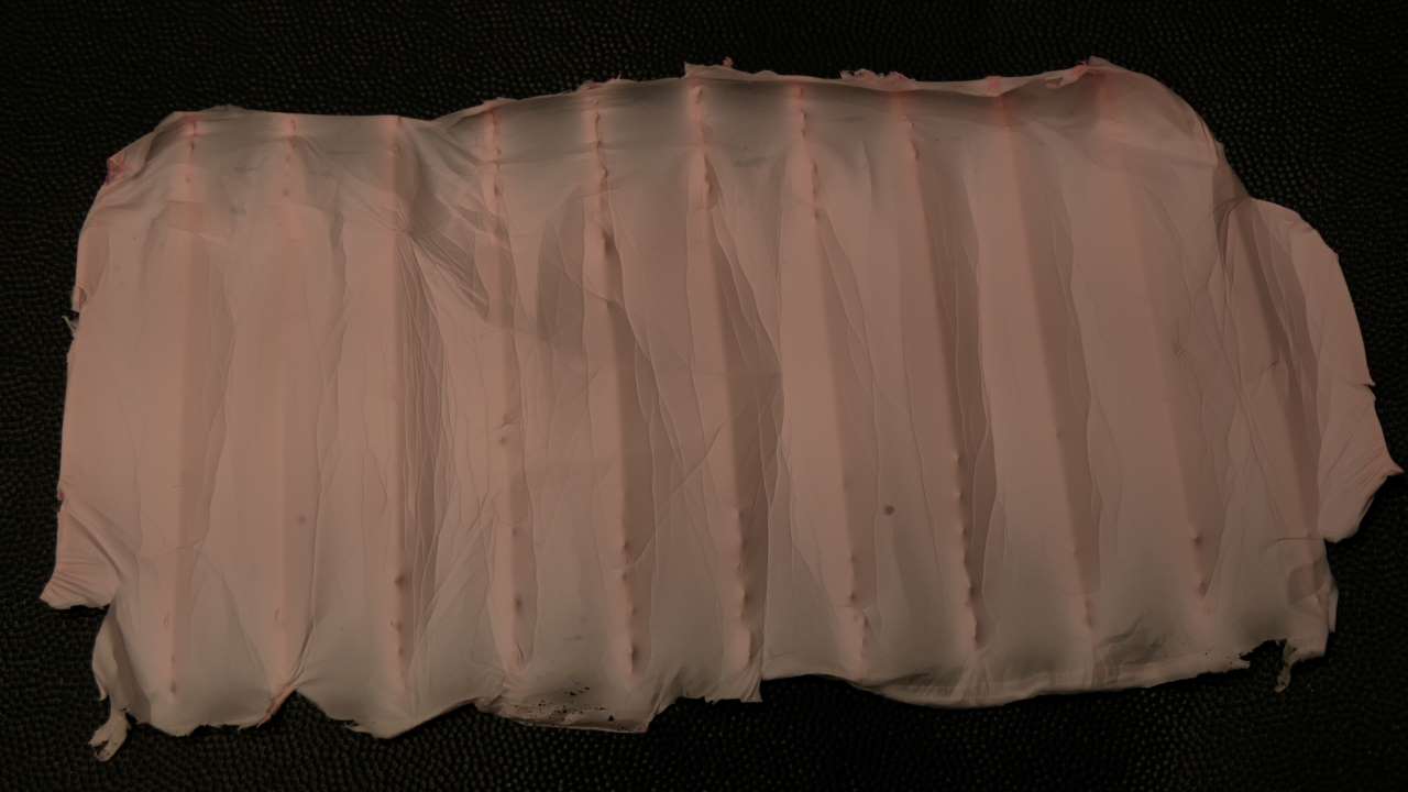 Coaxial Electrospinning for Targeted Drug Delivery in Wound Dressings